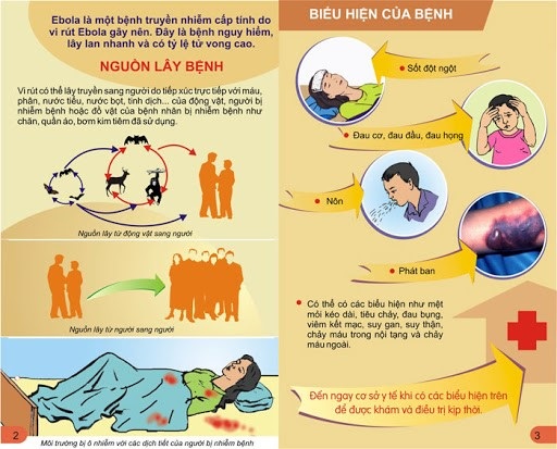 Các biểu hiện và nguồn lây bệnh Ebola mà người dân cần biết